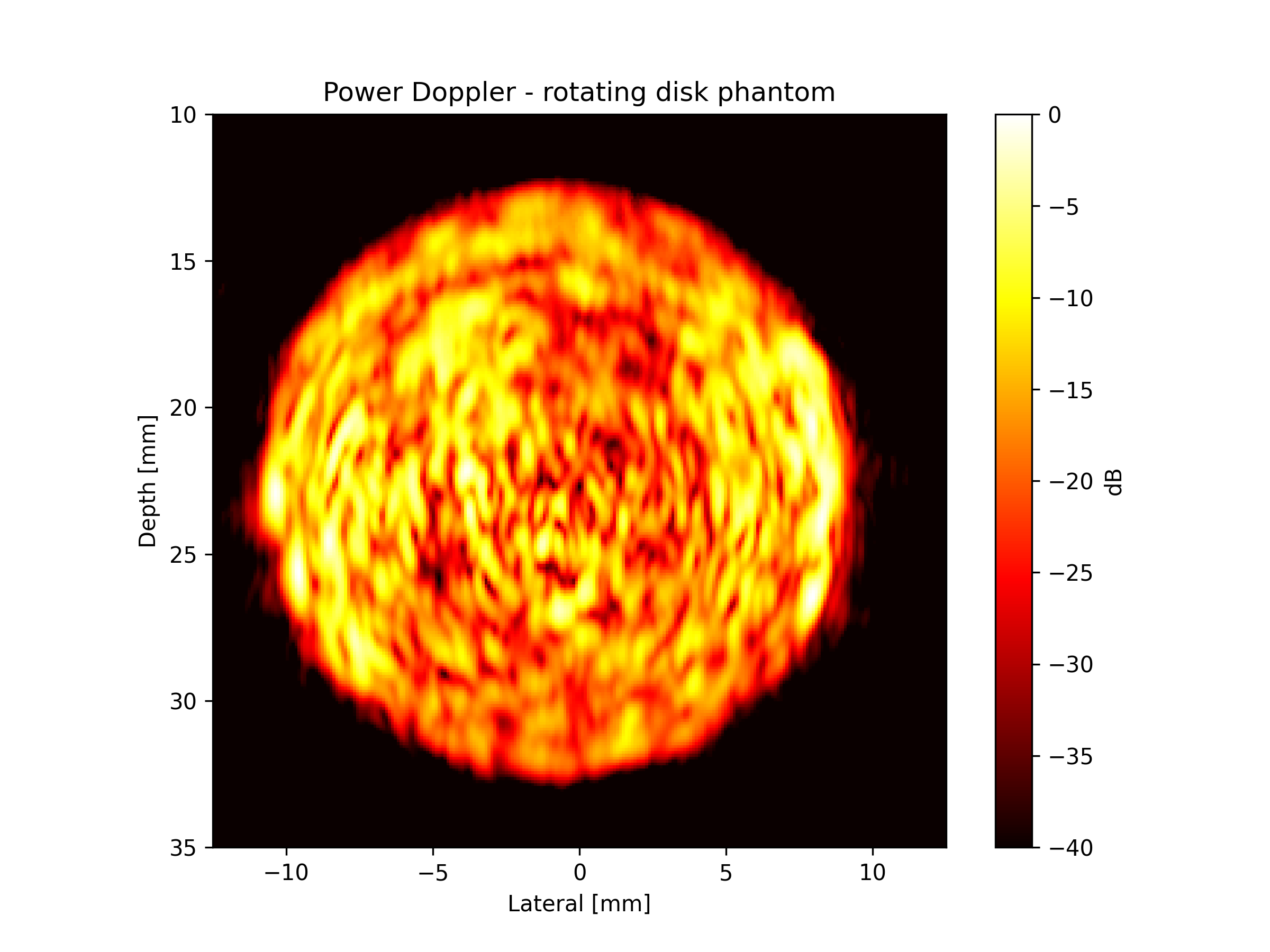 Power Doppler - rotating disk phantom