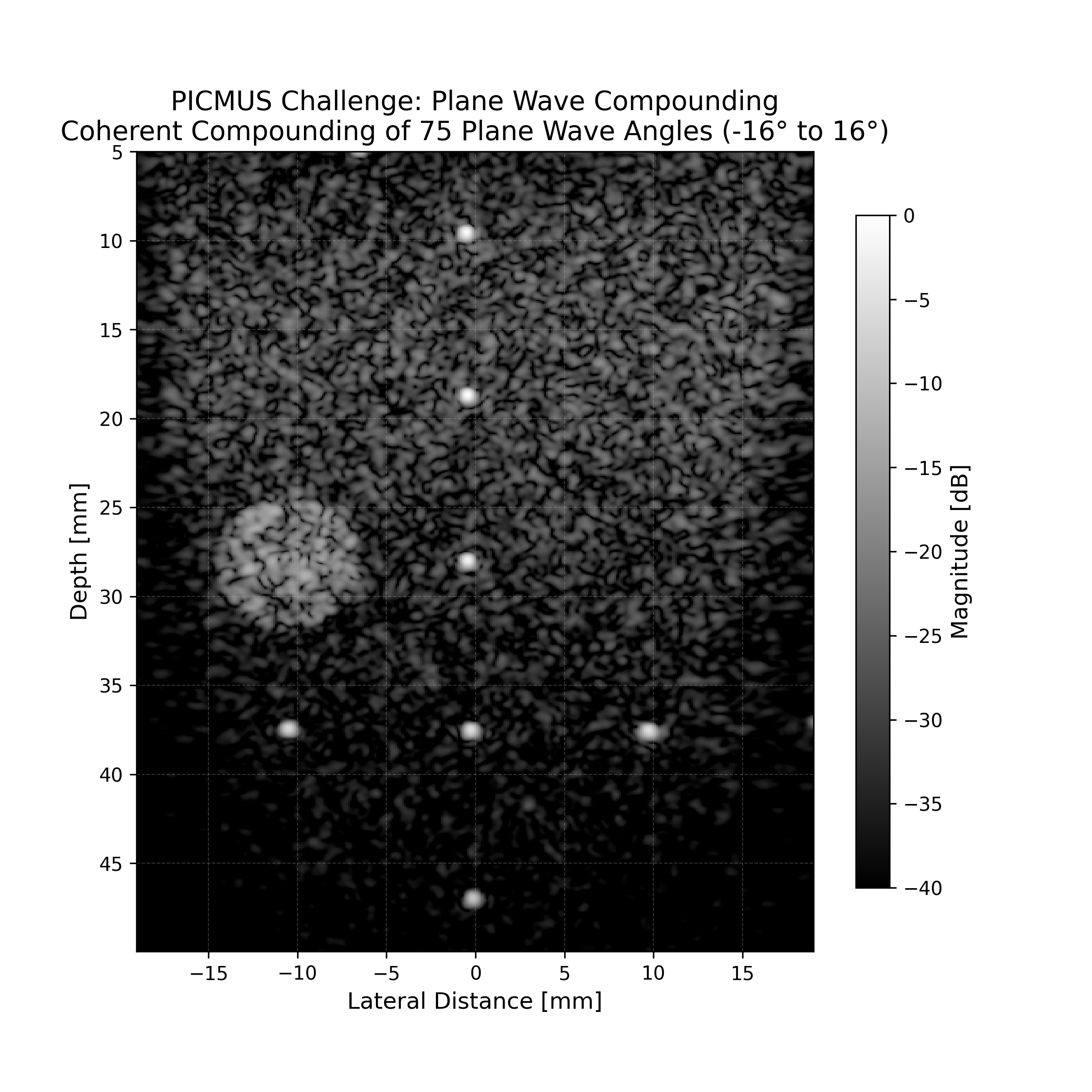 PICMUS Challenge: Plane Wave Compounding Coherent Compounding of 75 Plane Wave Angles (-16° to 16°)